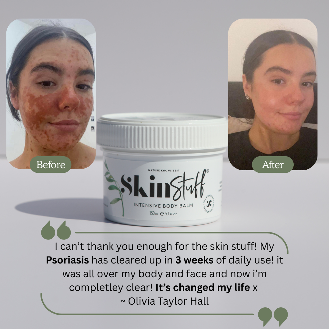 Skin & Scalp Rescue Duo