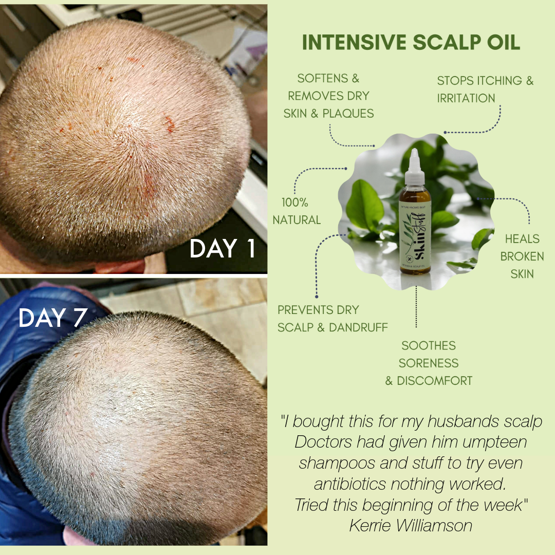 Soothes Scalps, Boosts Shine & Thickness