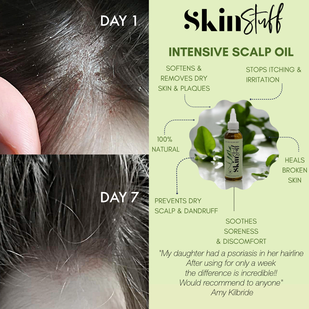 Soothes Scalps, Boosts Shine & Thickness