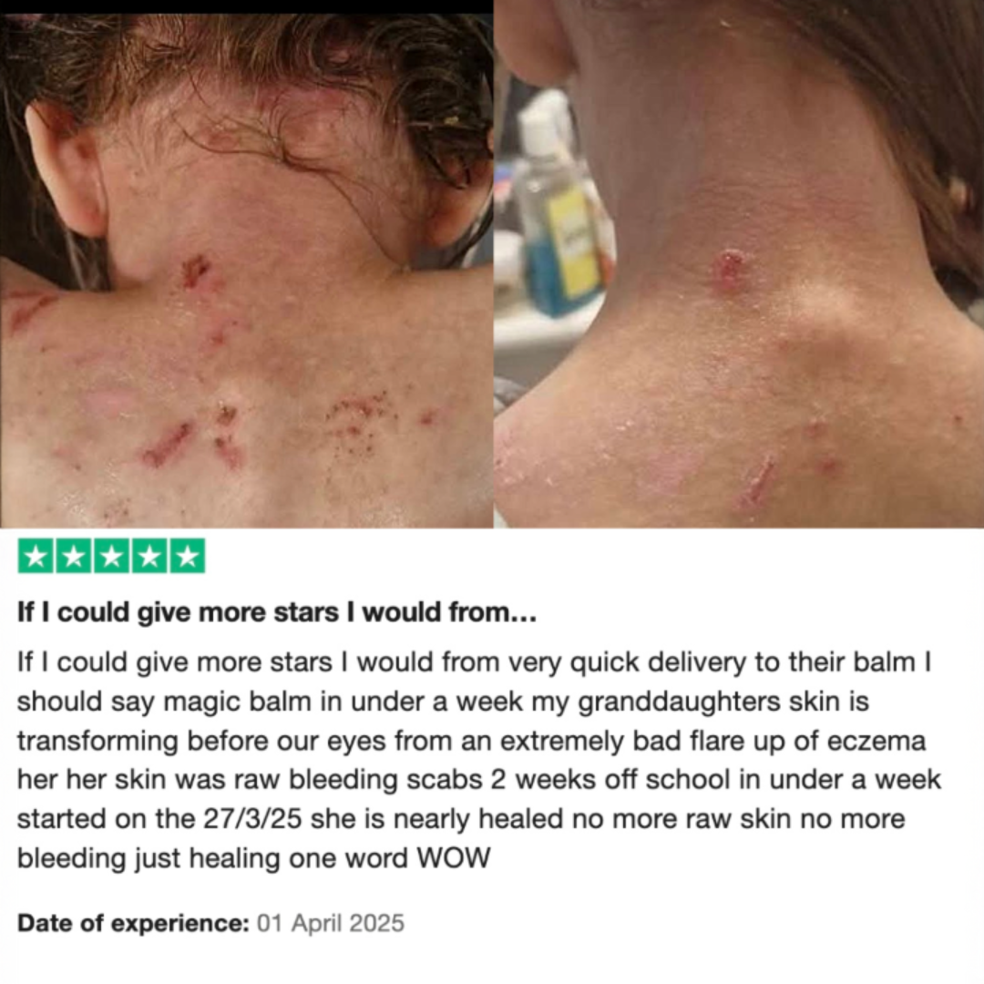 Skin Stuff 150ml – Soothe, Calm & Restore + FREE Skin Stuff 50ml + FREE Shipping