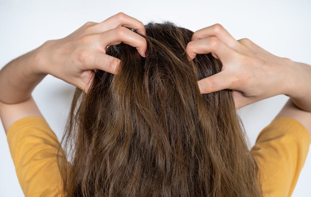 Why Is My Scalp So Itchy? - Stinky Stuff
