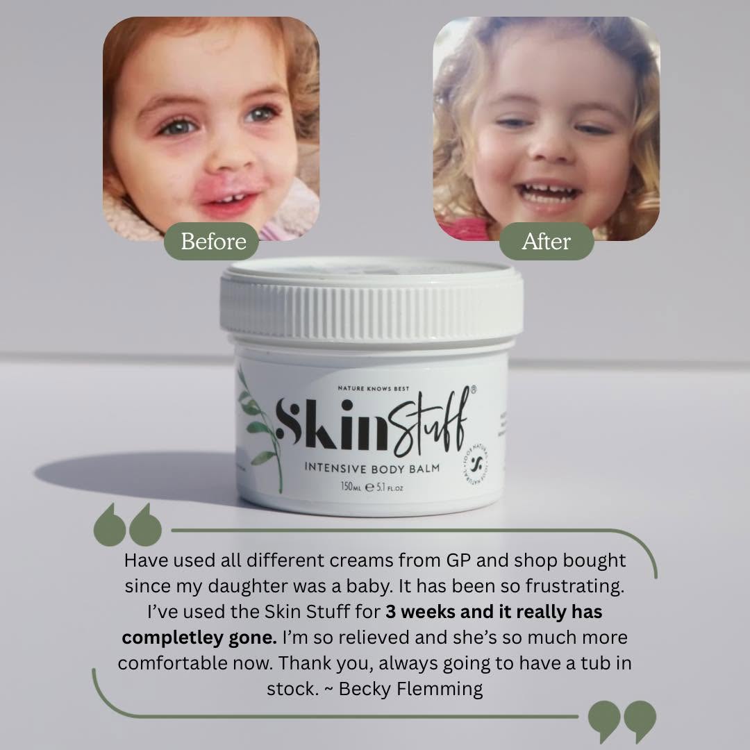 Natural Relief For Dry, Itchy & Sensitive Skin