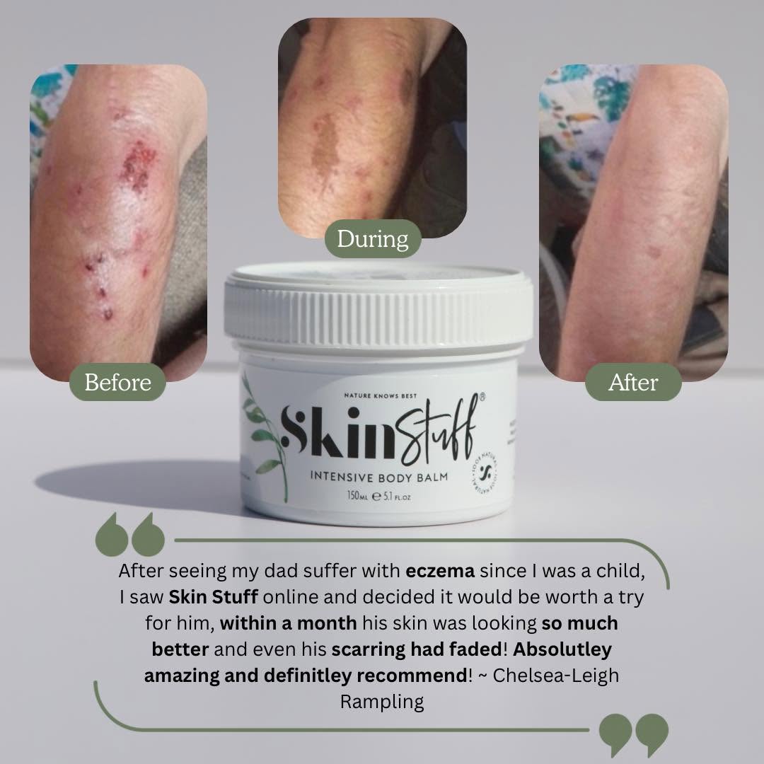 Natural Relief For Dry, Itchy & Sensitive Skin