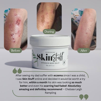 Natural Relief For Dry, Itchy & Sensitive Skin