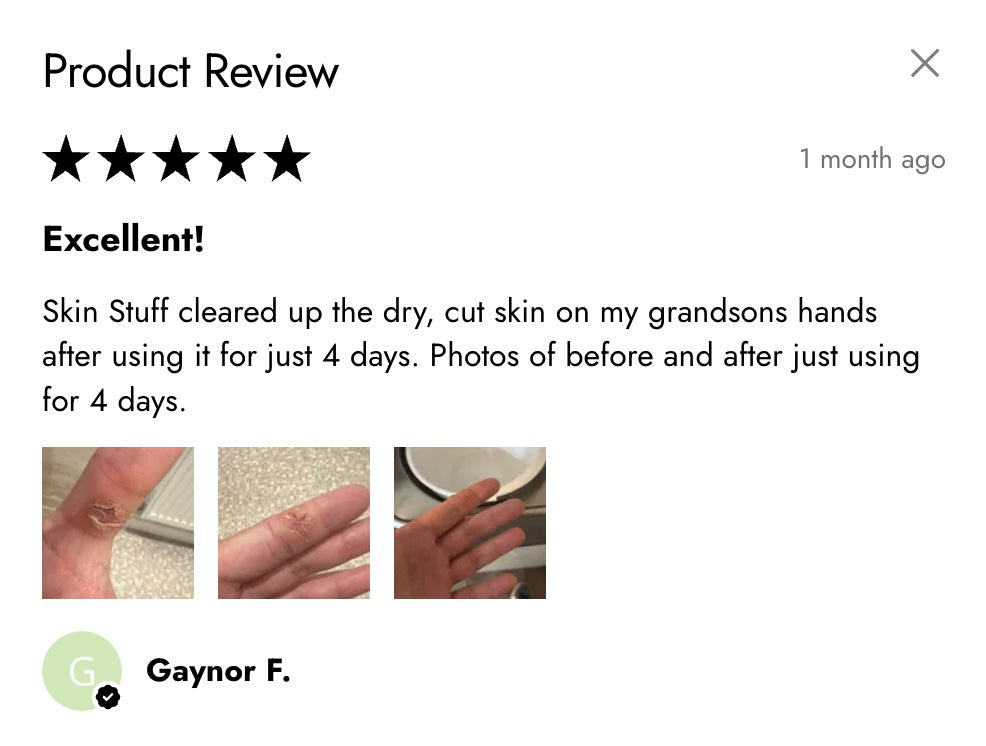 Skin Stuff – All-Natural Skin Nourishing Body Butter - Half Price