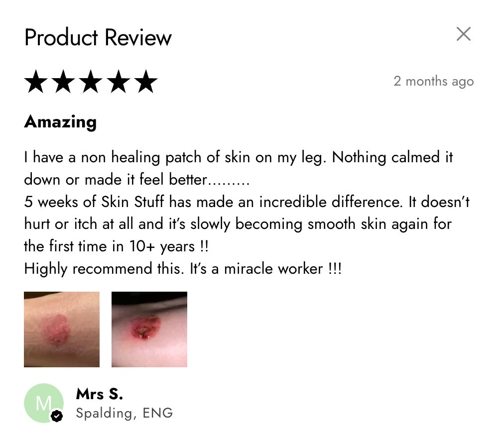 Skin Stuff – All-Natural Skin Nourishing Body Butter - Half Price