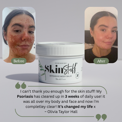 Skin & Scalp Rescue Duo
