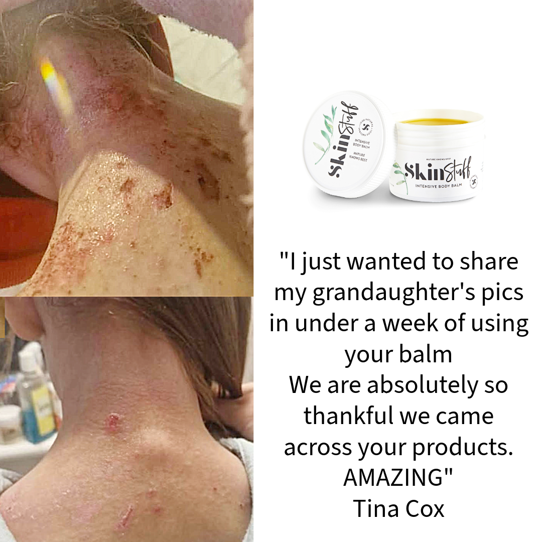 Skin Stuff Intensive Body Balm