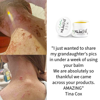 Skin Stuff Intensive Body Balm