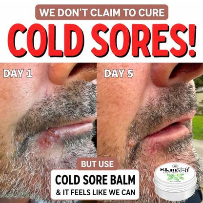 Cold Sore Balm - 100% Natural Cold Sore Remedy - Stinky Stuff