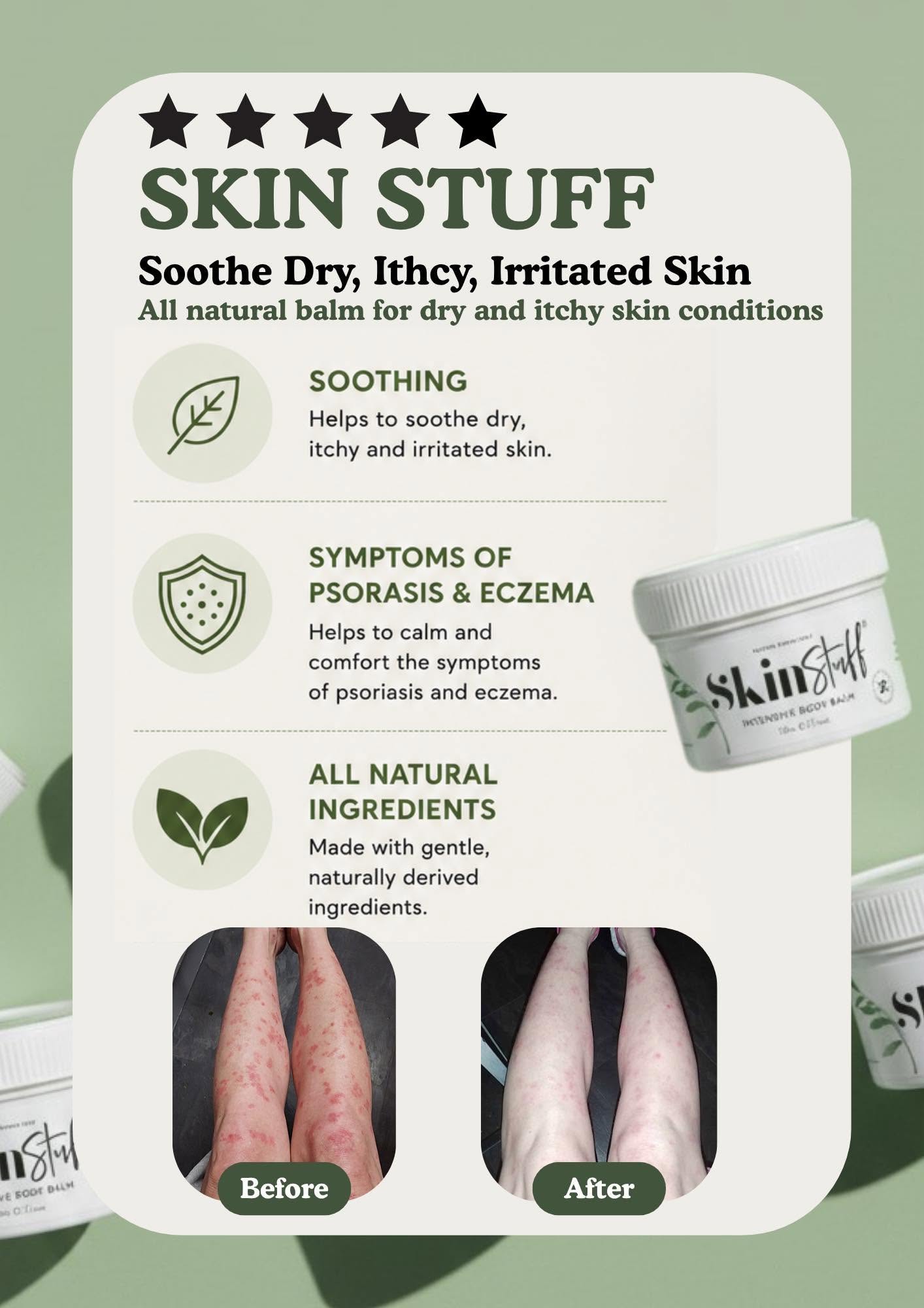 Natural Relief For Dry, Itchy & Sensitive Skin - Stinky Stuff