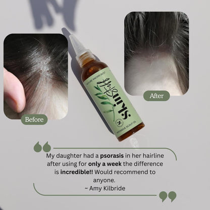 Skin & Scalp Rescue Duo - Stinky Stuff