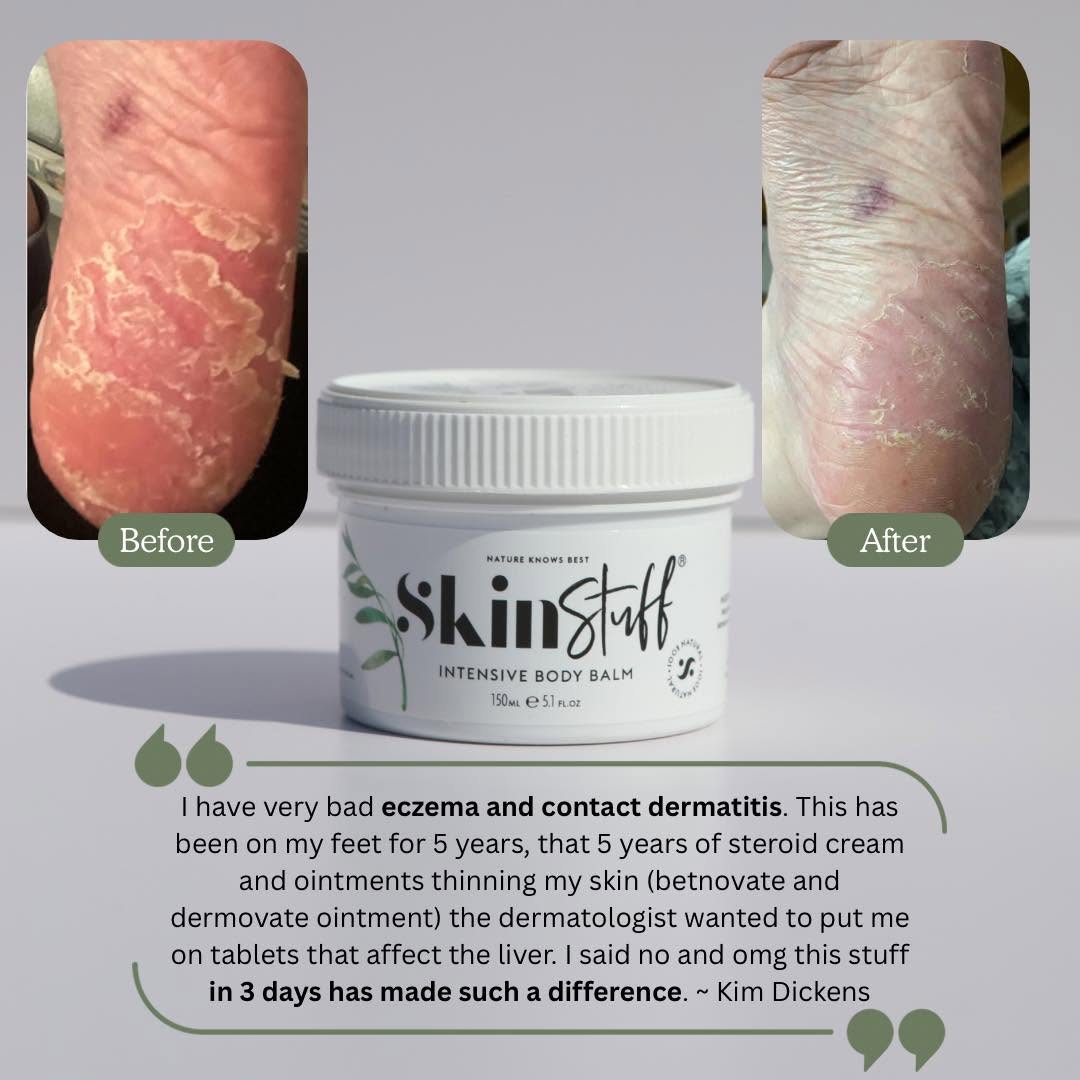 Skin & Scalp Rescue Duo - Stinky Stuff