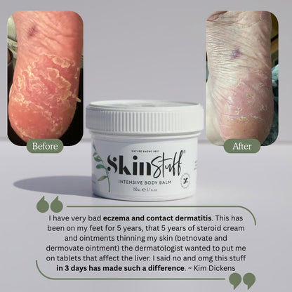 Skin & Scalp Rescue Duo - Stinky Stuff