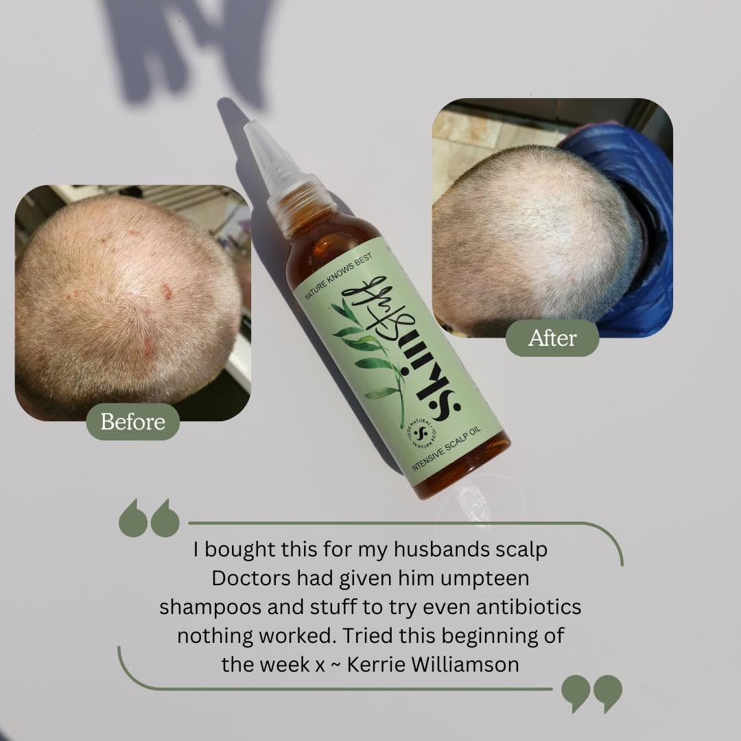 Skin & Scalp Rescue Duo - Stinky Stuff