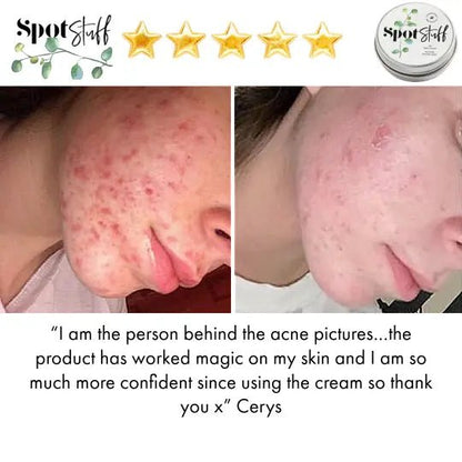 Spot Stuff - 100% Natural Spot Cream - Stinky Stuff