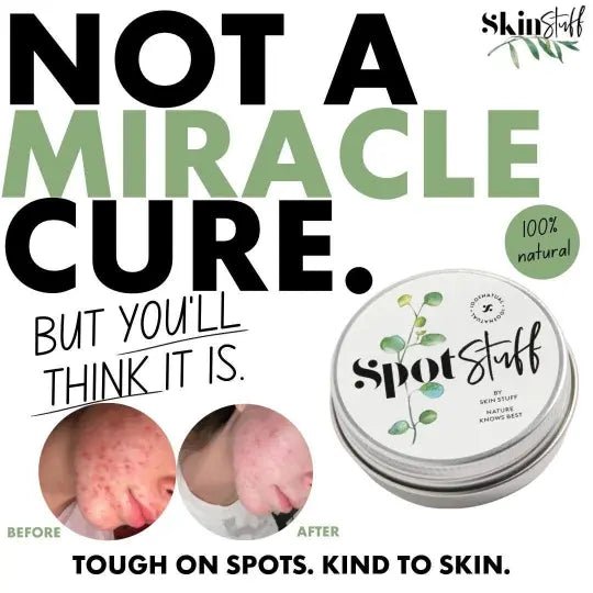 Spot Stuff - 100% Natural Spot Cream - Stinky Stuff